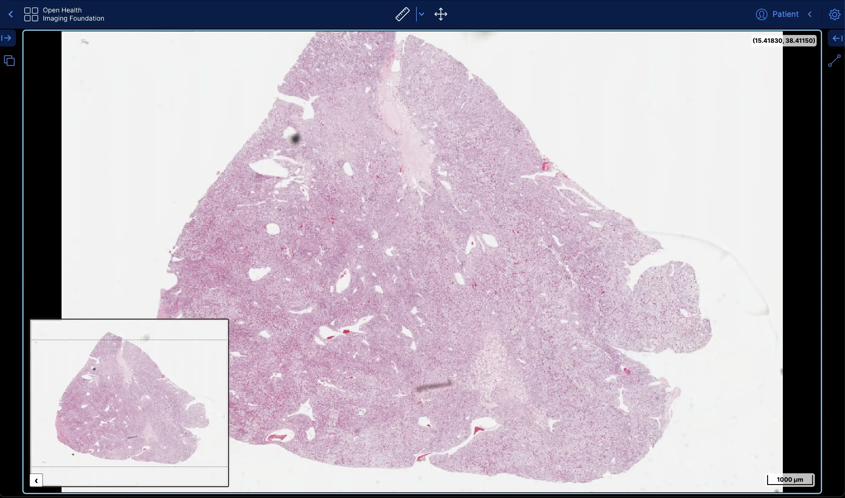 Open source pathology viewer with whole slide image tools
